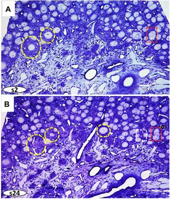 Light and focused ion beam microscopy workflow for resin-embedded tissues